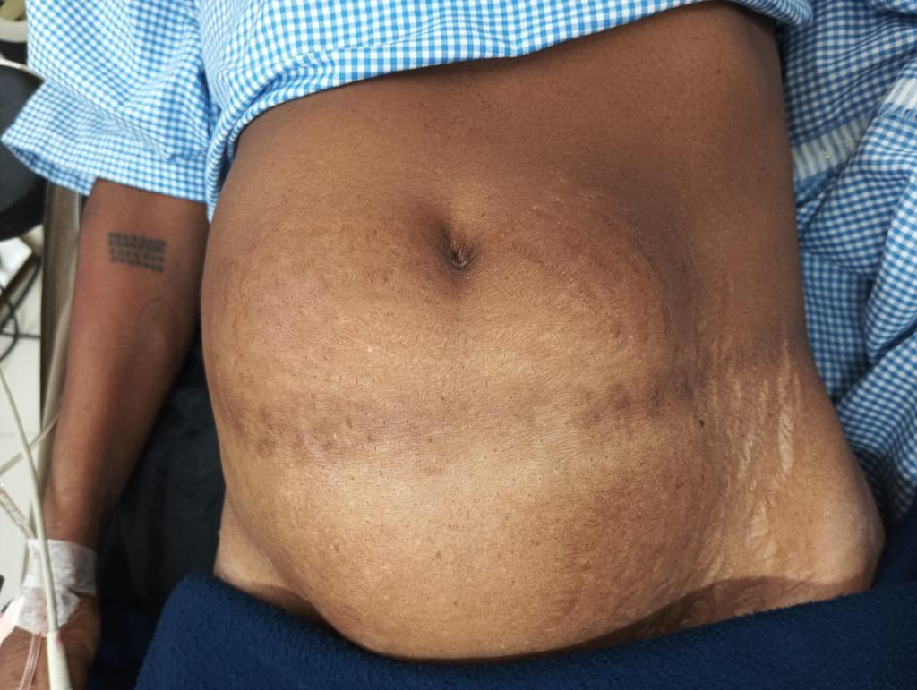 Safe Abortion Pills in Bangalore at Revive Hospitals