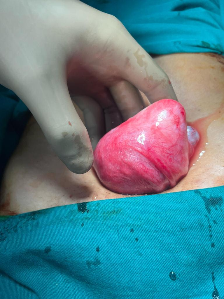 Safe Abortion Pills in Bangalore at Revive Hospitals